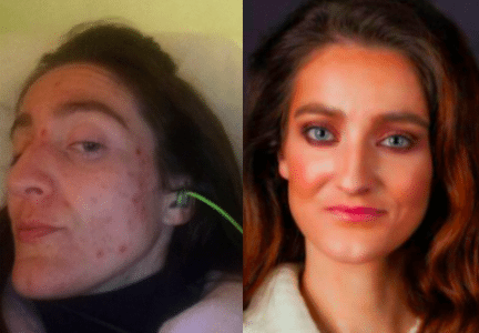 The Glowing Green Smoothie Saved My Life: Lindsay's Story