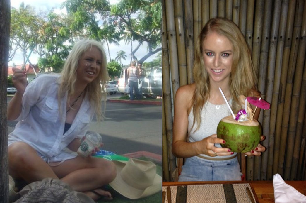 Kady Overcame Acne and Anxiety with the Beauty Detox Lifestyle!