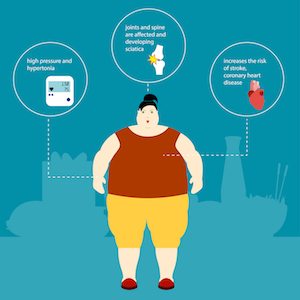 Obesity Vector illustration Fat woman and the plaque with the description of the effects of obesity and weight gain Infographic