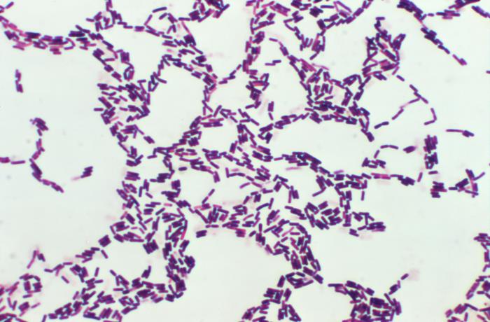 Gram stain of the probiotic, Bacillus coagulans. This SBO probiotic is one of the ingredients in the Feel Good SBO Probiotics+ supplement.